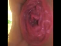 Poop Fetish Porn - Crazy prolapsed ass hole played with on stream